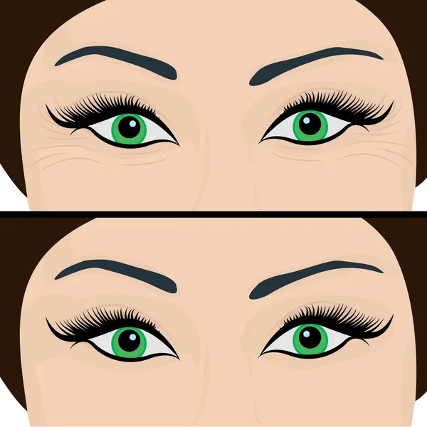 Wrinkles and fine lines under eyes to remove. Before and After. Eyes lifting — Stock Vector