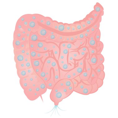 Bloating and excess gas in intestine clipart