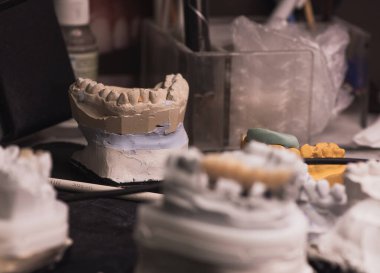 İnsan çenesinin alçıtaşı modelleri, diş implantları. Diş teknisyeninin masası.