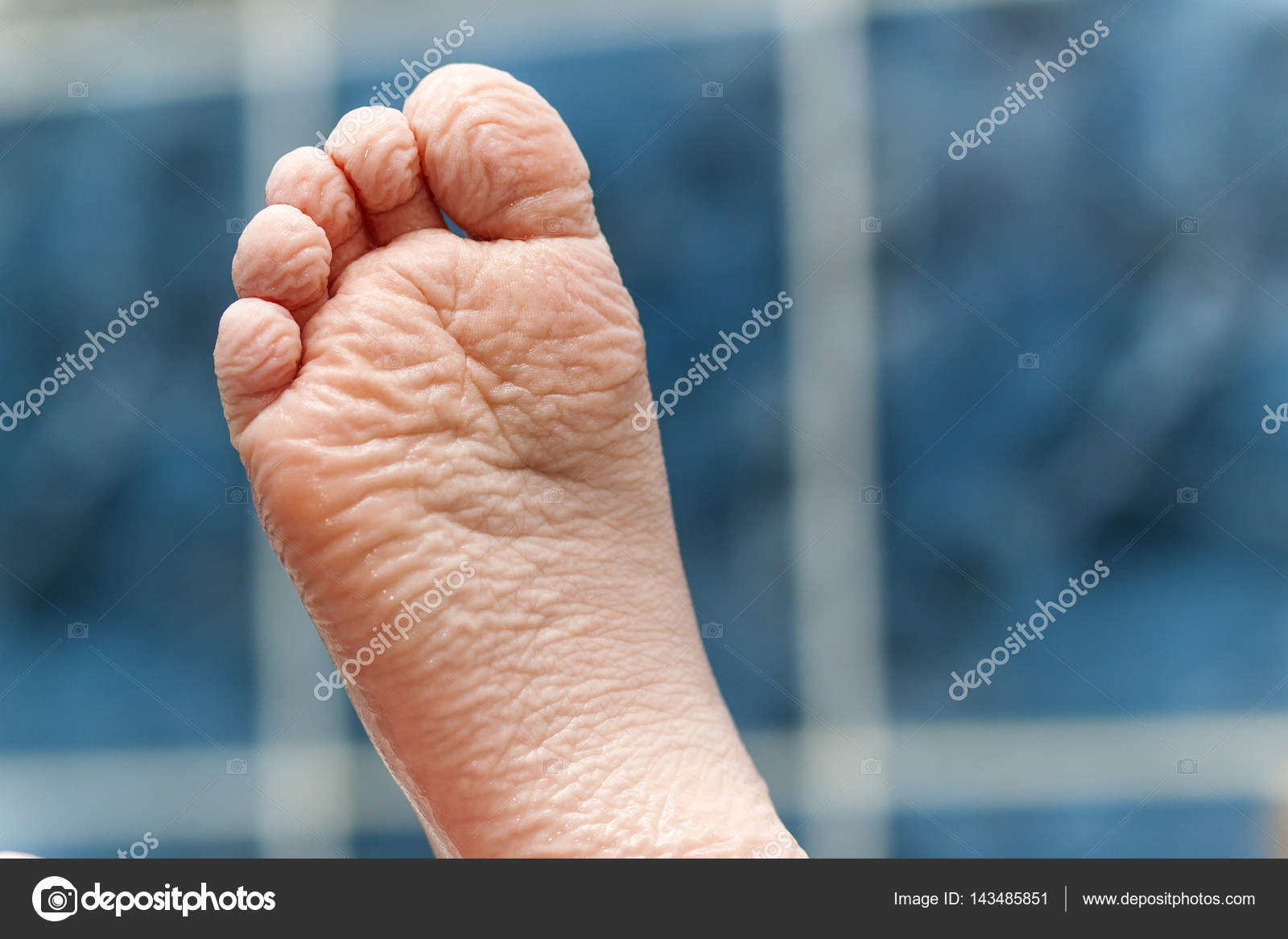 Wrinkled Soles Pics