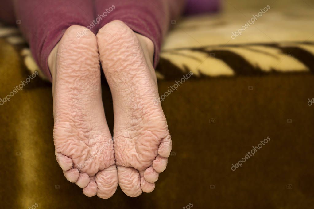 Feet pics wrinkled Dirty Feet