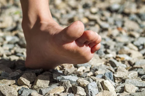 Κοντινό πλάνο γυμνά πόδια, το περπάτημα πάνω σε πέτρες, υπαίθρια δραστηριότητα — Φωτογραφία Αρχείου