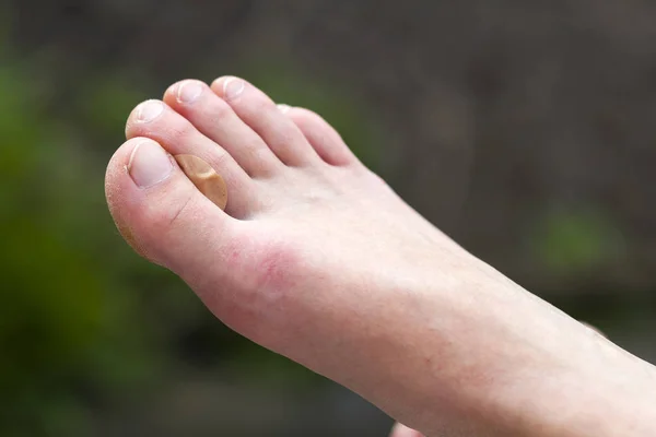 Close-up of isolated pair of woman 's clean white dry feet with u — стоковое фото