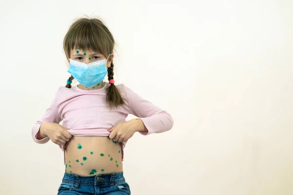 Mädchen Mit Blauer Medizinischer Schutzmaske Erkrankt Windpocken Masern Oder Röteln — Stockfoto