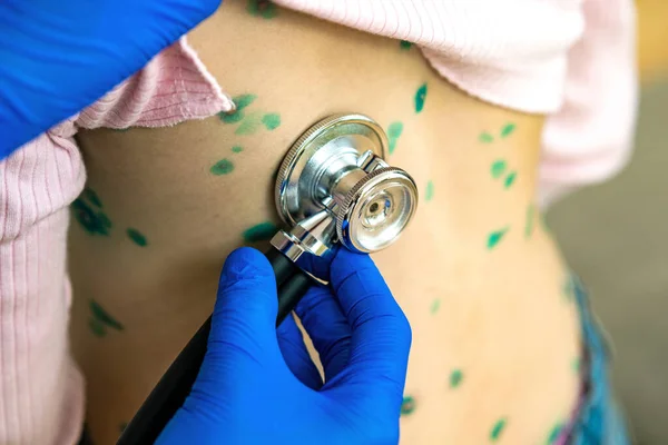 Médico Examinando Niño Con Estetoscopio Cubierto Erupciones Verdes Espalda Enfermo —  Fotos de Stock