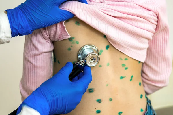 Médico Examinando Niño Con Estetoscopio Cubierto Erupciones Verdes Espalda Enfermo —  Fotos de Stock