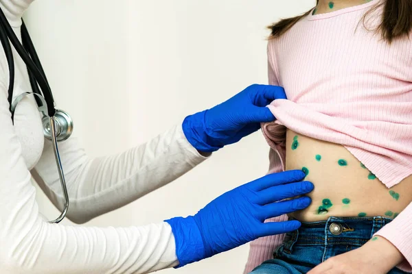 Doctor examining a child covered with green rashes on stomach ill with chickenpox, measles or rubella virus.
