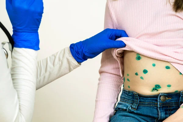 Dokter Die Een Kind Onderzoekt Dat Bedekt Met Groene Huiduitslag — Stockfoto