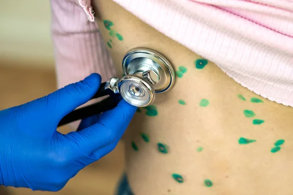 Médico Examinando Niño Con Estetoscopio Cubierto Erupciones Verdes Espalda Enfermo —  Fotos de Stock