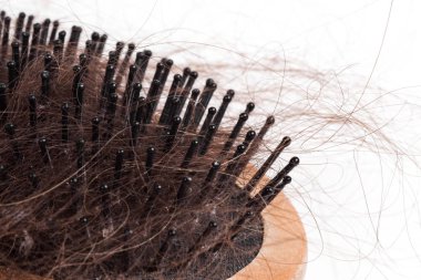 Tarak içinde dolaşmış zarlarını saç