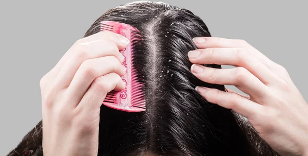 Femme enlève les pellicules du peigne à cheveux noirs — Photo