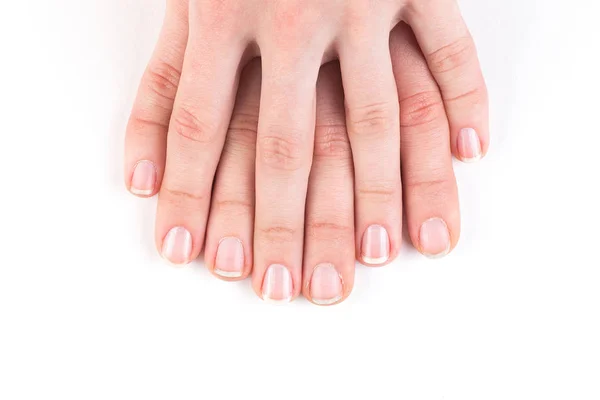 Porównanie piękne i brzydkie manicure — Zdjęcie stockowe