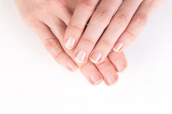 Comparison of the beautiful and the ugly manicure — Stock Photo, Image