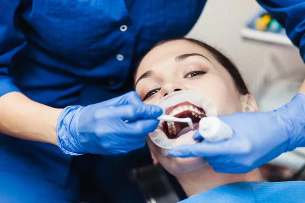 Dentista sosteniendo procedimiento de blanqueamiento dental — Foto de Stock