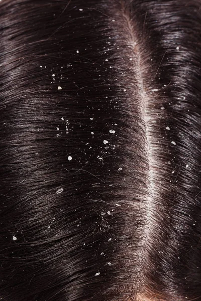 Forfora sui suoi capelli scuri — Foto Stock