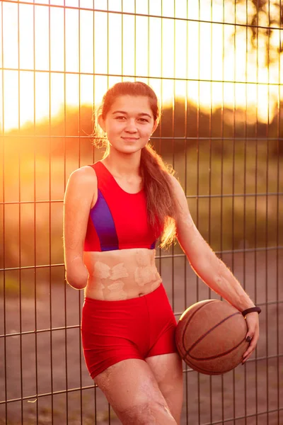 Kolu Kesilmiş Vücudunda Yanıklar Olan Genç Bir Kadın Sporcu Portresi — Stok fotoğraf