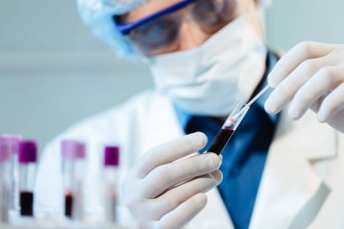 Bir virüs doktoru, Covid-19 virüslü bir kan örneğini inceliyor..
