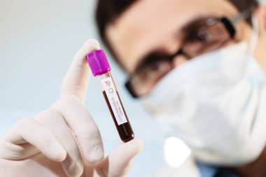 Bir virüs doktoru, Covid-19 virüslü bir kan örneğini inceliyor..