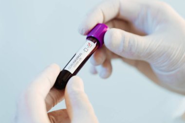 Bir virüs doktoru, Covid-19 virüslü bir kan örneğini inceliyor..