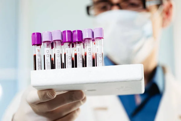 Médico Virólogo Está Examinando Una Muestra Análisis Sangre Con Sospecha — Foto de Stock