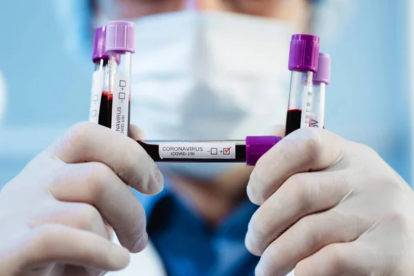 Médico Virólogo Está Examinando Una Muestra Análisis Sangre Con Sospecha — Foto de Stock