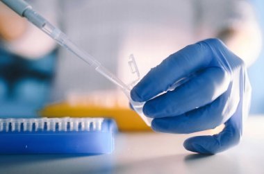 Virüs enfeksiyonları için laboratuvar testleri. Coronavirus ncov, Mers-Cov solunum sendromu koronavirüsü. Kanser testleri.