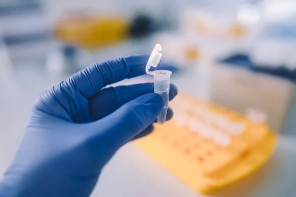 Virüs enfeksiyonları için laboratuvar testleri. Coronavirus ncov, Mers-Cov solunum sendromu koronavirüsü. Kanser testleri.