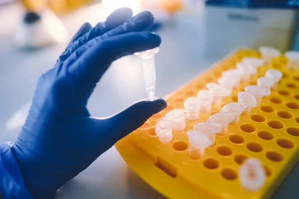 Laboratory tests for viral infections. Coronavirus nCoV, MERS-Cov respiratory syndrome coronavirus. Tests for cancer.