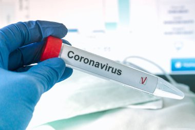 Corona virüs testi ya da COVID-19 testi. Eldivenler, üzerinde korona virüsü test etiketi olan bir test tüpü taşıyor. Arka plandaki analiz verileri. SARS-CoV-2 test konsepti.
