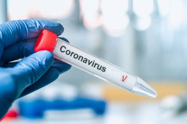 Coronavirus testi. Eldivenler, arka planda bulanık laboratuvar üzerinde Corona virüsü test etiketi olan bir test tüpü tutuyor. COVID-19 veya SARS-CoV-2 test konsepti.