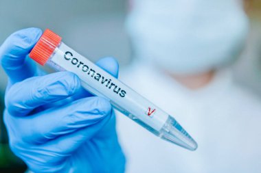 Solunum koruyucu maskeli ve labotator eldivenli hemşire üzerinde pozitif koronavirüs test etiketi olan bir test tüpü tutuyor. COVID-19 veya SARS-CoV-2 tanı konsepti.
