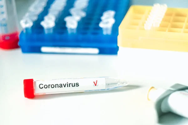 Prueba del Coronavirus. Mano en guantes sostiene un tubo de ensayo con una etiqueta de prueba del virus corona en el laboratorio borroso en el fondo. Concepto de prueba COVID-19 o SARS-CoV-2 . — Foto de Stock