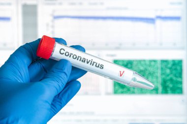 COVID-19 testi. Eldivenlerin içinde, üzerinde korona virüsü test etiketi bulunan bir test tüpü var. Coronavirus veya SARS-CoV-2 test konsepti.