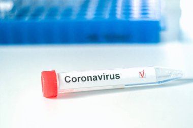 Coronavirus testi. Eldivenler, arka planda bulanık laboratuvar üzerinde Corona virüsü test etiketi olan bir test tüpü tutuyor. COVID-19 veya SARS-CoV-2 test konsepti.