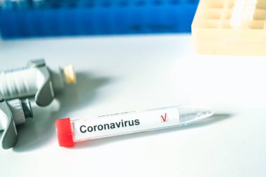 Coronavirus testi. Eldivenler, arka planda bulanık laboratuvar üzerinde Corona virüsü test etiketi olan bir test tüpü tutuyor. COVID-19 veya SARS-CoV-2 test konsepti.