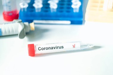 Coronavirus testi. Eldivenler, arka planda bulanık laboratuvar üzerinde Corona virüsü test etiketi olan bir test tüpü tutuyor. COVID-19 veya SARS-CoV-2 test konsepti.