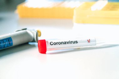 Coronavirus testi. Eldivenler, arka planda bulanık laboratuvar üzerinde Corona virüsü test etiketi olan bir test tüpü tutuyor. COVID-19 veya SARS-CoV-2 test konsepti.
