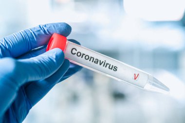 Coronavirus testi. Eldivenler, arka planda bulanık laboratuvar üzerinde Corona virüsü test etiketi olan bir test tüpü tutuyor. COVID-19 veya SARS-CoV-2 test konsepti.