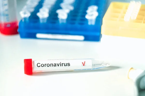 Test Del Coronavirus Mano Nei Guanti Tiene Una Provetta Con — Foto Stock