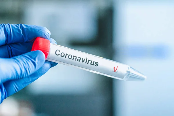 Coronavirus testi. Eldivenler, arka planda bulanık laboratuvar üzerinde Corona virüsü test etiketi olan bir test tüpü tutuyor. COVID-19 veya SARS-CoV-2 test konsepti.
