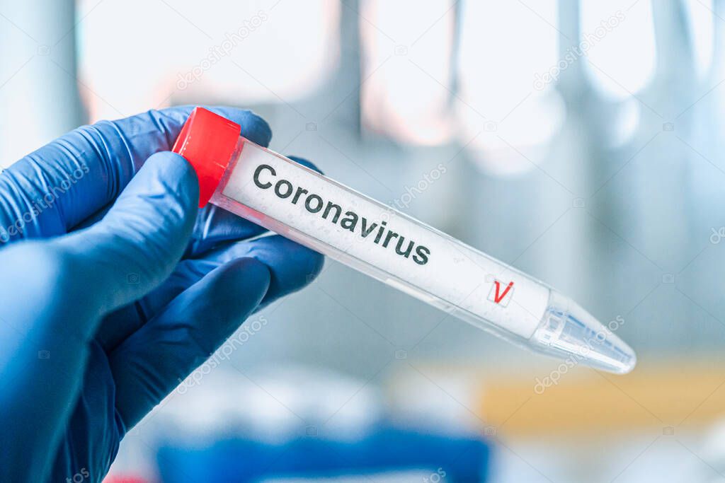 Coronavirus test. Hand in gloves holds a test tube with a corona virus test label on blurred laboratory in the background. COVID-19 or SARS-CoV-2 test concept.