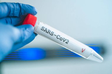 Coronavirus testi. Eldivenler, arka planda bulanık laboratuvar üzerinde Corona virüsü test etiketi olan bir test tüpü tutuyor. COVID-19 veya SARS-CoV-2 test konsepti.