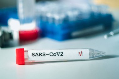 Coronavirus testi. Eldivenler, arka planda bulanık laboratuvar üzerinde Corona virüsü test etiketi olan bir test tüpü tutuyor. COVID-19 veya SARS-CoV-2 test konsepti.