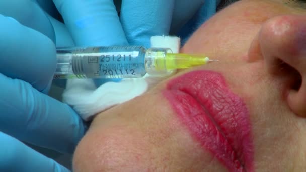Косметическая инъекция в клинике — стоковое видео