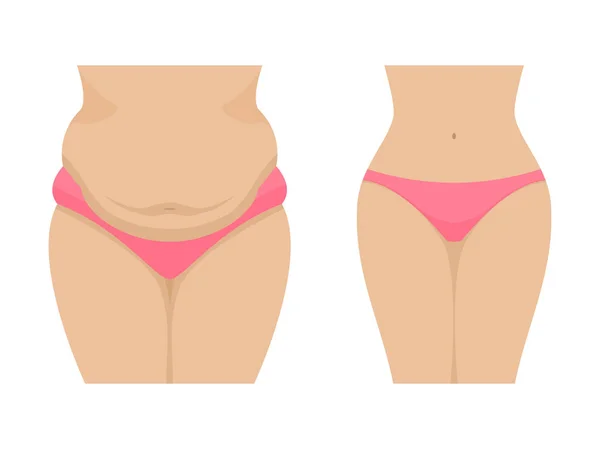 Ilustração vetorial de uma barriga feminina gorda e fina —  Vetores de Stock