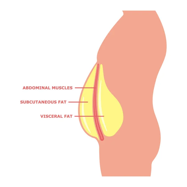 Gordura visceral em um corpo masculino isolado em branco — Vetor de Stock