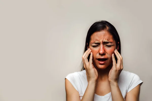 Vrouw Met Pijnlijke Hete Zonnebrand Roodheid Van Gezichtshuid Probleem Lichtgevoeligheid — Stockfoto