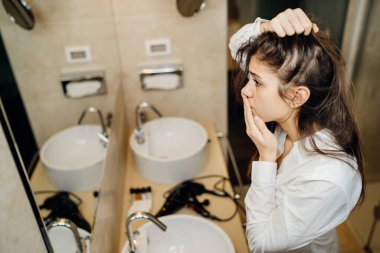Genç kadın alopecia 'dan muzdarip. Kadın saçı dökülmüş. Endişeli bir kadın aynada saç çizgisine bakıyor. Stres, otoimmün hastalıklar, saç bakım ürünlerinden kellik, alerjik reaksiyon.