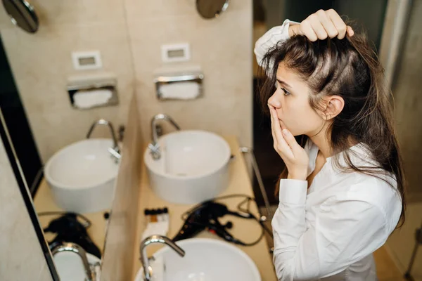 Genç kadın alopecia 'dan muzdarip. Kadın saçı dökülmüş. Endişeli bir kadın aynada saç çizgisine bakıyor. Stres, otoimmün hastalıklar, saç bakım ürünlerinden kellik, alerjik reaksiyon.