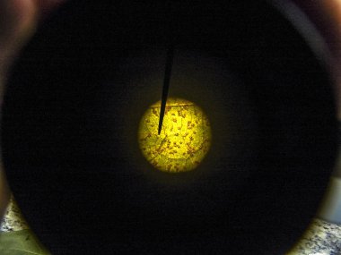 Soya yaprak görünümü mikroskop objektifinden üzerinde Asya pas (Phakopsora pachyrhizi)